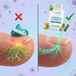 Fungus Eliminator™ – Restaurador Natural de Uñas y Pies